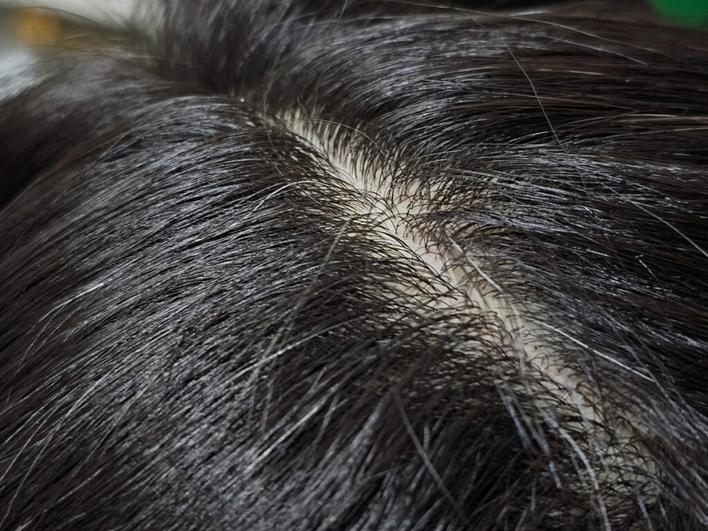 건강한 두피 관리 머리숱 모발 hair scalp