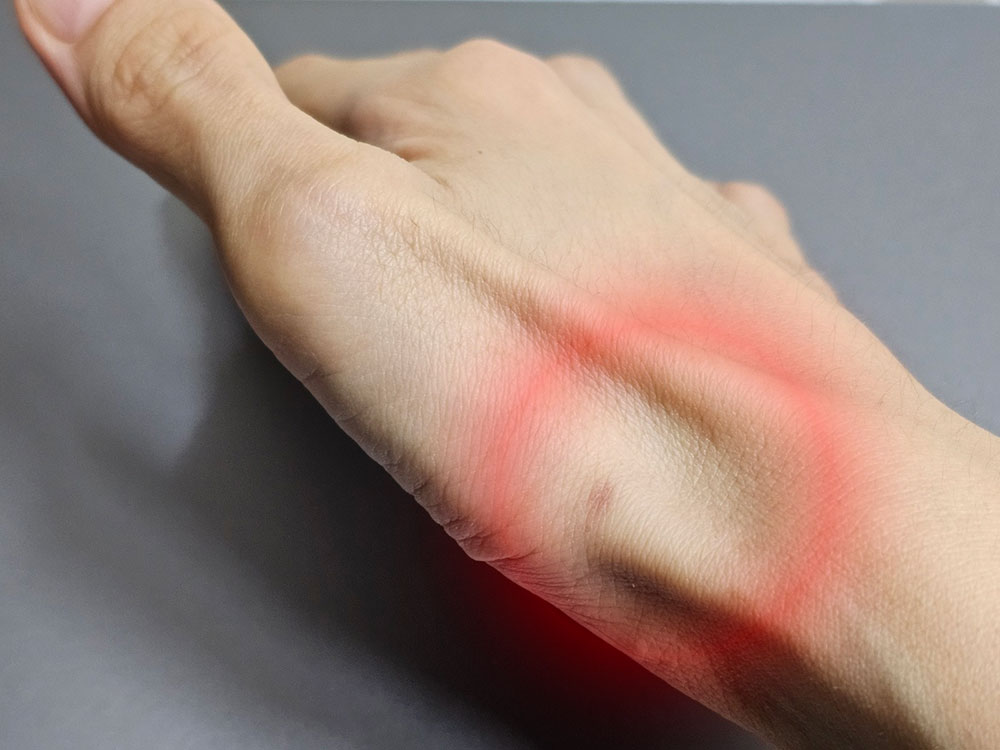 손목 건초염 증상 회복기간 치료 스트레칭 손  손목건초염